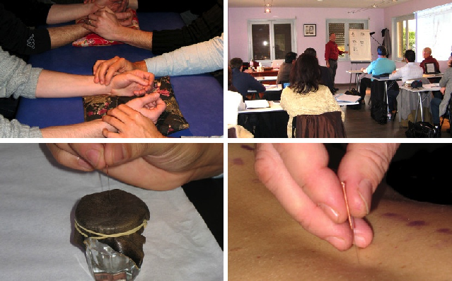 Formation acupuncture avec Bruno Repetto